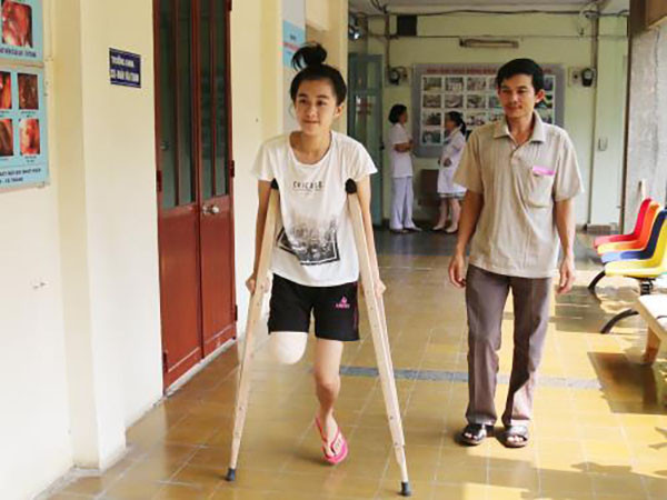 Em Lê Thị Hà Vi. (Nguồn: Báo Thanh niên) Điểm lại 6 sự cố y khoa gây “rúng động” trong năm 2016 ảnh 1