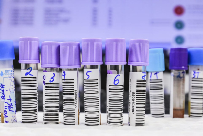 Sáng 19/8: Hà Nội ghi nhận 5 ca mắc COVID-19, chủ yếu ở quận Đống Đa ảnh 1