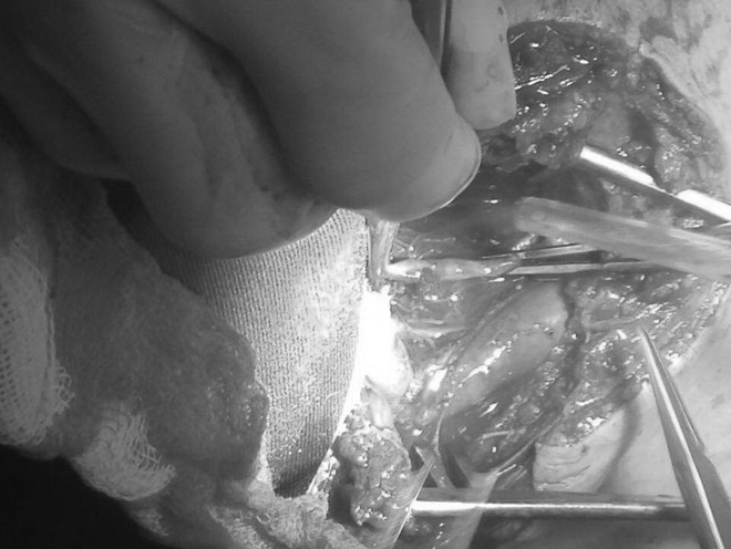 Hà Nội: 1 người đàn ông bị chó béc giê nhà cắn tử vong ảnh 1