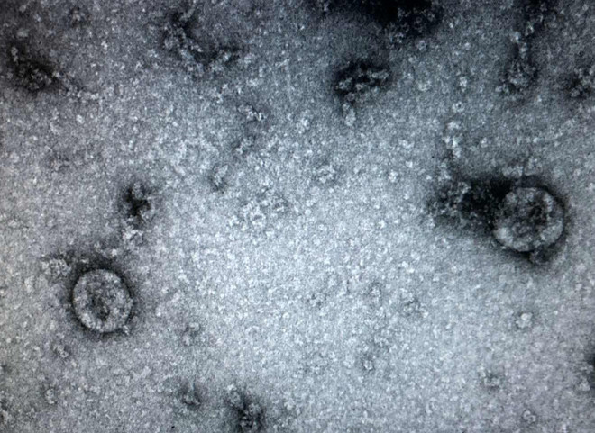 Việt Nam là 1 trong 4 nước phân lập thành công virus corona chủng mới ảnh 1