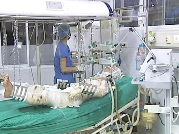 Hội chẩn liên viện điều trị 3 chiến sỹ trong vụ máy bay rơi ảnh 1