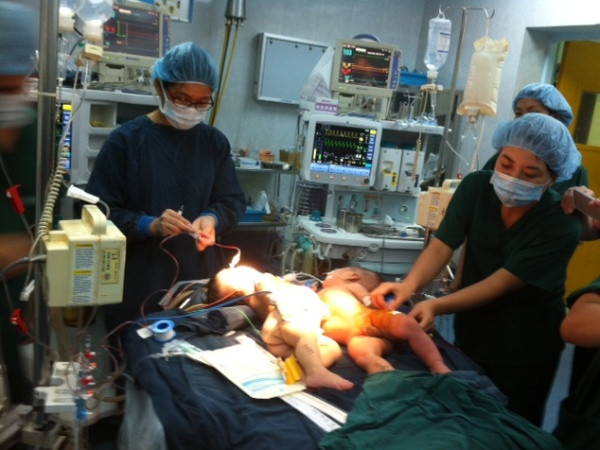 Phẫu thuật tách thành công hai trẻ 4 tháng tuổi dính liền bụng ảnh 1
