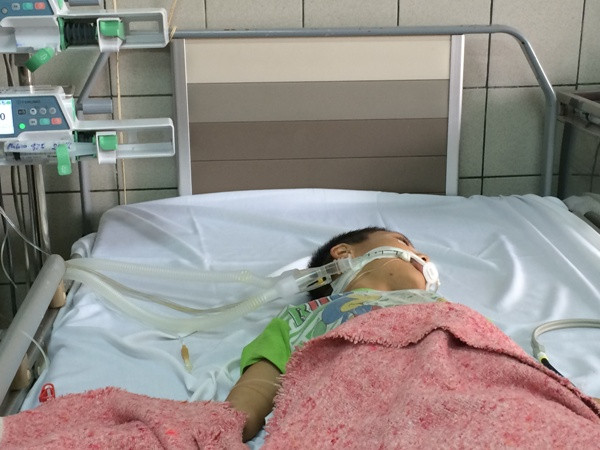 Một bé trai bị hôn mê nặng sau khi ăn sắn cao sản nướng ảnh 1