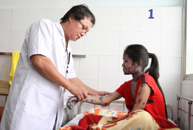 Miền Bắc đang bước vào đợt cao điểm của dịch thủy đậu ảnh 1