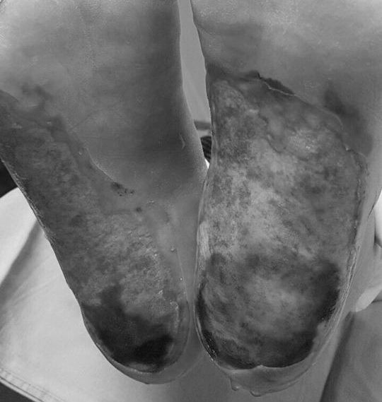 Bệnh nhân tiểu đường không nên dùng đèn sưởi đá muối Himalaya ảnh 1