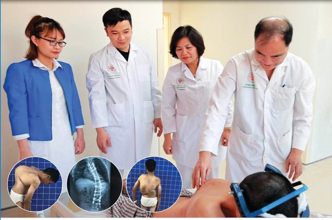 Phẫu thuật lấy lại hình dạng cho bệnh nhân gù vẹo cột sống đặc biệt ảnh 1