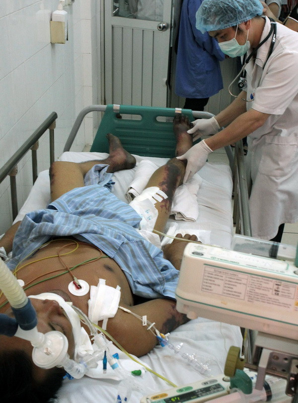 Ăn tiết canh lợn cắp nách, xuất hiện ban hoại tử khắp toàn thân ảnh 1