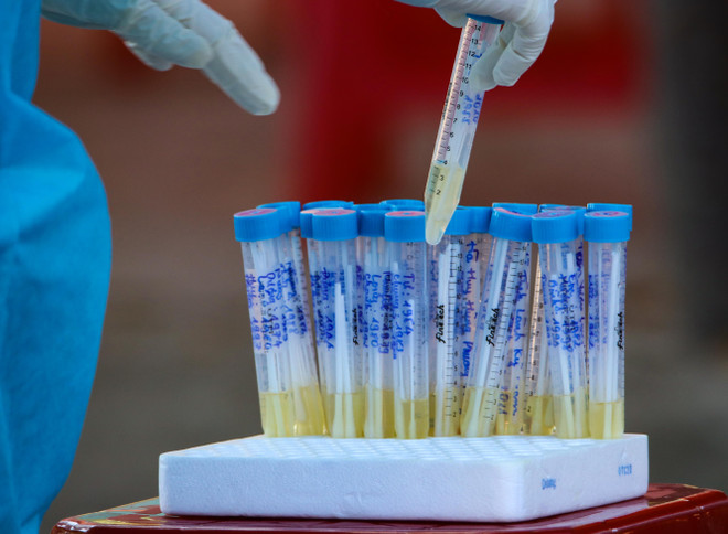 Thêm 1 ca mắc mới COVID-19 từ Australia về, được cách ly ngay ảnh 1