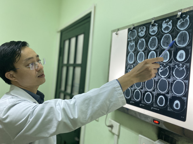 Tiến sỹ Bùi Huy Mạnh xem phim chụp của bệnh nhân. (Ảnh: PV/Vietnam+) Người đàn ông mất bàn tay phải do nổ bình ga mini khi nấu ăn ảnh 1