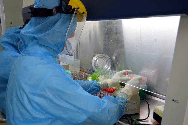 Ca tử vong thứ 75 do COVID-19: Bệnh nhân cao tuổi, có bệnh nền ảnh 1