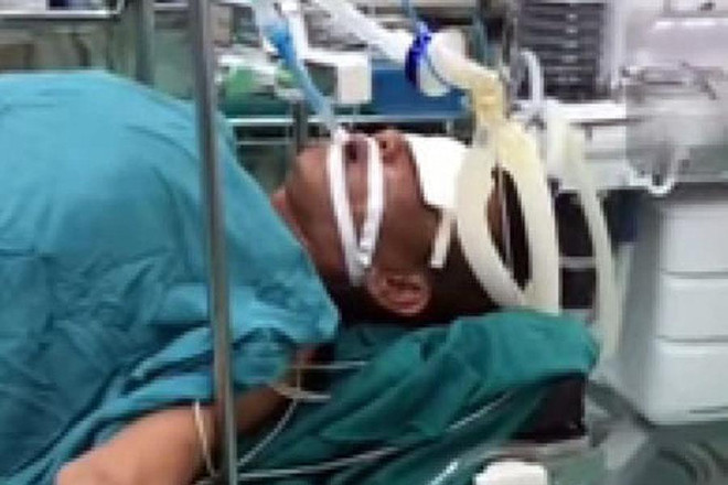 Dùng miệng hút dầu diesel, một người bị tổn thương phổi trầm trọng ảnh 1