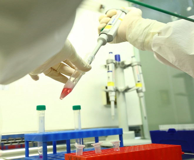 Trường hợp thứ 32 mắc COVID-19 tử vong vì bệnh lý nền nặng ở Việt Nam ảnh 1