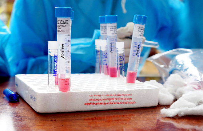 Bệnh nhân 426 tử vong vì bệnh COVID-19 và suy thận giai đoạn cuối ảnh 1