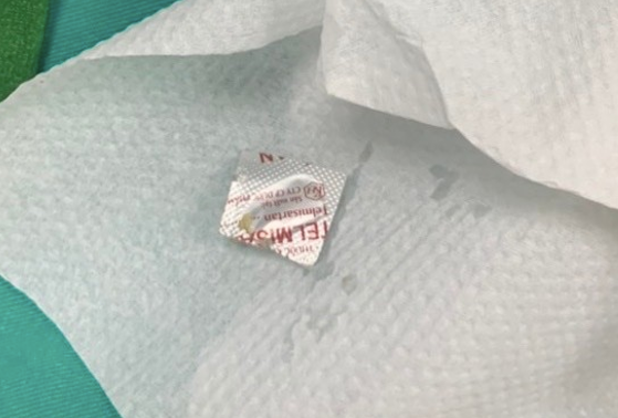 Gắp thành công dị vật viên thuốc cả vỏ sắc nhọn ở thực quản bệnh nhân ảnh 1