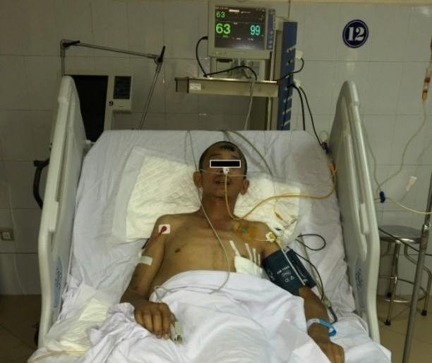 Rơi thang vận từ tầng 5, một người ở Phú Thọ bị đa chấn thương ảnh 1