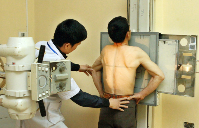 Rà soát các máy X-quang do nguy cơ ảnh hưởng sức khỏe ảnh 1