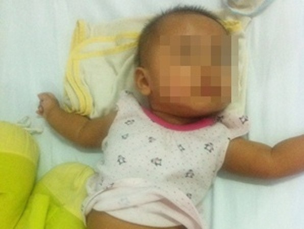 Bé gái 6 tháng tuổi phải cắt bỏ buồng trứng vì thoát vị bẹn ảnh 1