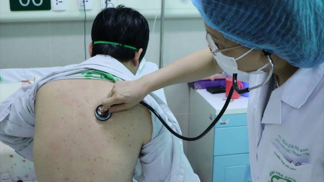 Hy hữu: Điều trị một người đàn ông 43 tuổi mắc bệnh ho gà ảnh 1