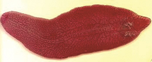 Ăn đồ sống, nhiều bệnh nhân nguy kịch do nhiễm sán lá gan ảnh 2