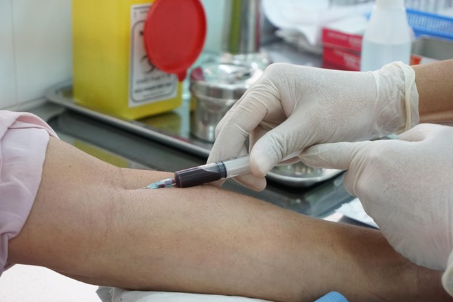 Dịch HIV ở Việt Nam đang ngày càng trở nên khó kiểm soát ảnh 1