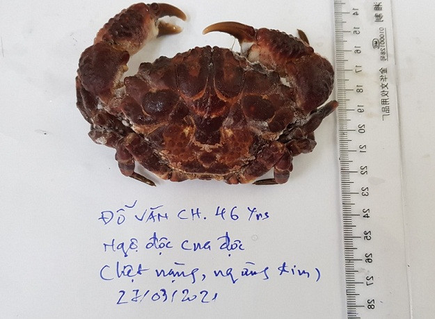 Một ngư dân bị ngộ độc và ngừng tuần hoàn vì ăn cua mặt quỷ ảnh 1