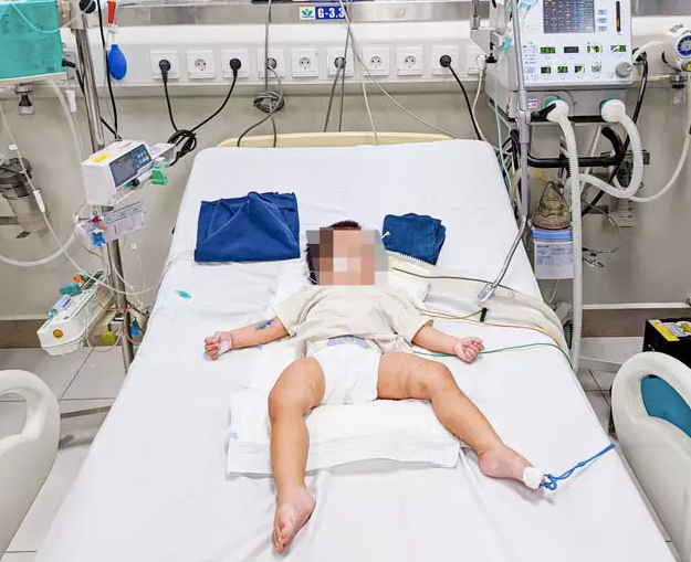 Bé 18 tháng tuổi nghi bị bạo hành: Có biểu hiện về di chứng thần kinh ảnh 1