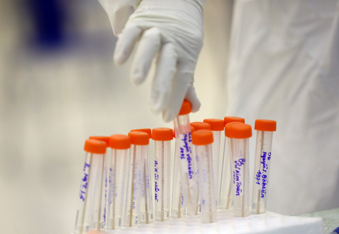 Người đã mắc biến thể BA.1, BA.2 vẫn có thể mắc lại BA.4, BA.5 ảnh 1