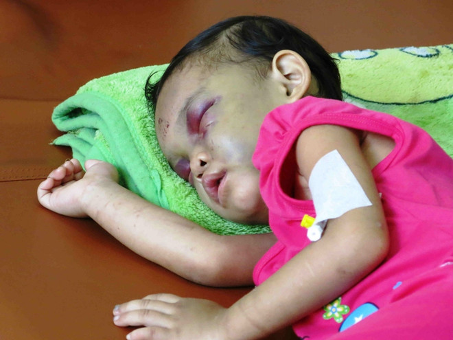 40% trẻ em trong các vụ bạo hành bị tổn thương ở mắt ảnh 1