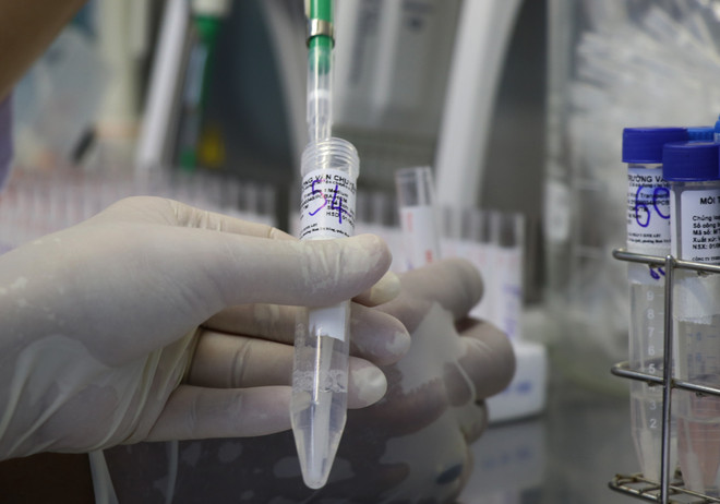 Ngày 19/2: Hà Nội thêm 4.869 ca mắc COVID, có 1.206 ca cộng đồng ảnh 1