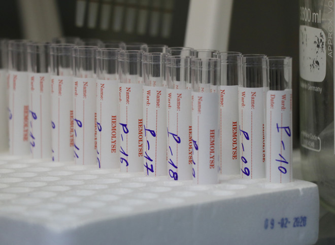 Cảnh báo nhiều mặt hàng liên quan phòng chống dịch không rõ nguồn gốc ảnh 1