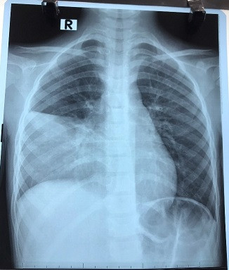 Chuyên gia phân tích về phòng bệnh viêm phổi do vi khuẩn Mycoplasma ảnh 2