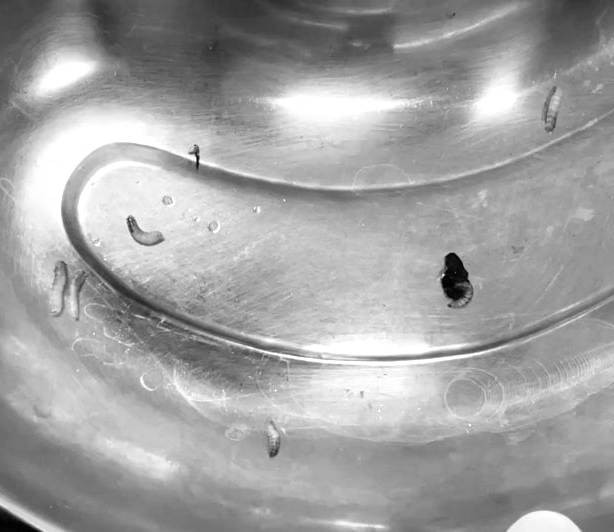 Hàng chục con giòi làm tổ trong tai giữa của một nam bệnh nhân ảnh 1