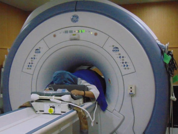 Ứng dụng công nghệ điều trị u xơ tử cung không phẫu thuật ảnh 1