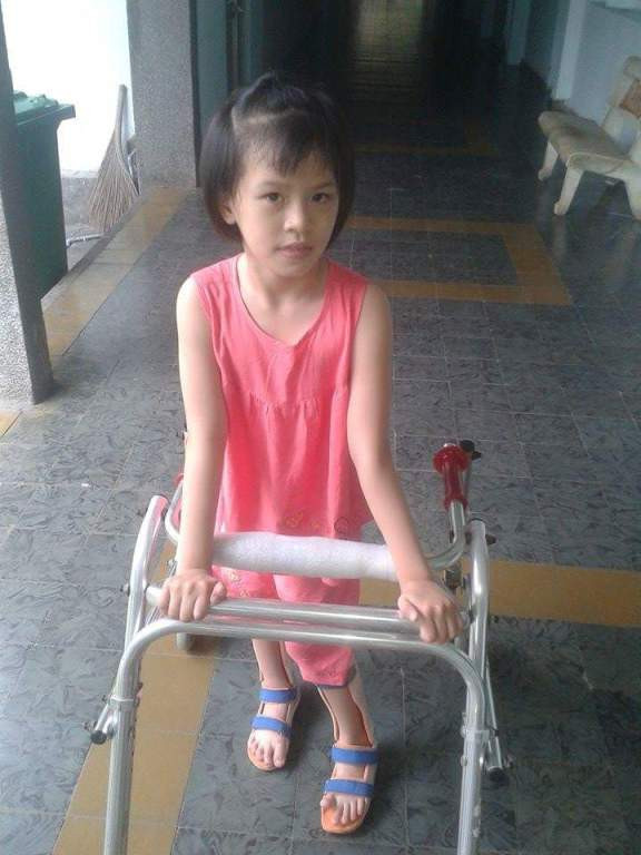 Vinmec ghép tế bào gốc chữa bại não thành công cho 1 bệnh nhân ảnh 2