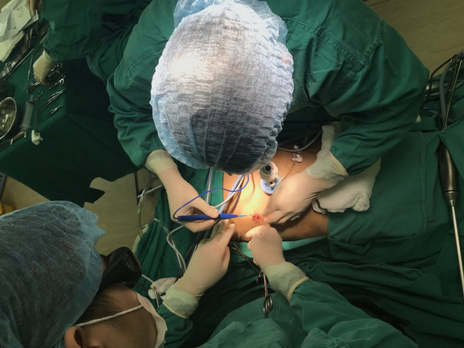 Bệnh viện K thực hiện thành công phẫu thuật nội soi 3D - 1 lỗ Trocart ảnh 1