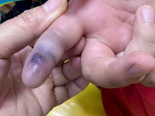 Mua rắn độc về làm thú cưng, bé trai ở Hà Nội nguy hiểm tính mạng ảnh 3