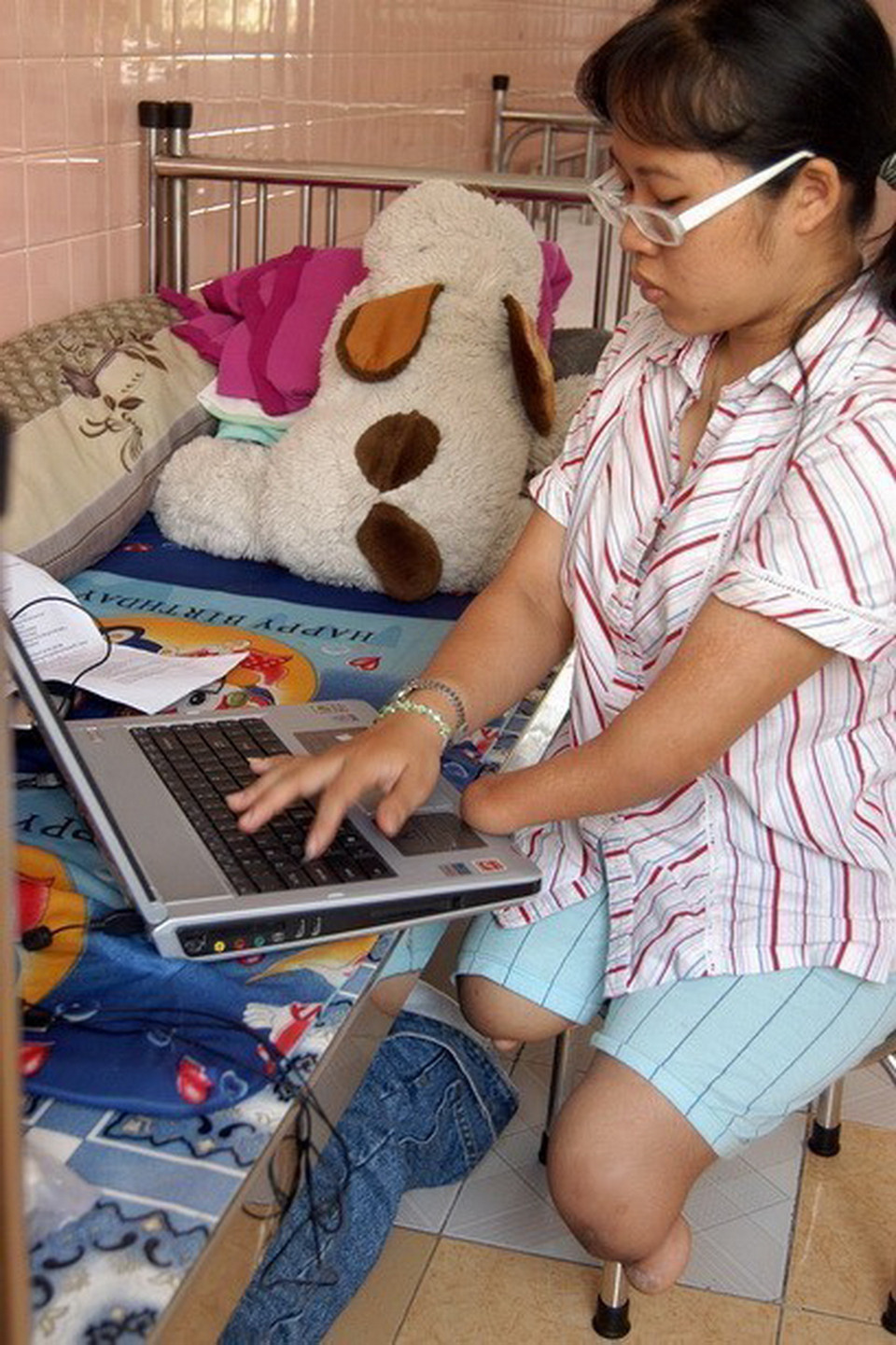 Em Trần Thị Hoan (sinh năm 1986), bị dị tật, dị dạng từ bẩm sinh do di chứng chất độc da cam/dioxin nhưng Hoan luôn nỗ lực rèn luyện tự phục vụ bản thân và học tập giỏi, em đang là sinh viên năm thứ 2 khoa Công nghệ thông tin, trường Đại học Ngoại ngữ Thành phố Hồ Chí Minh (2008). (Ảnh: Dương Ngọc/TTXVN)