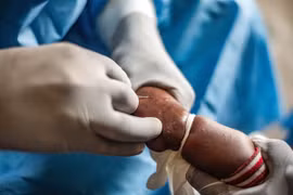 Nhân viên y tế điều trị cho bệnh nhân mắc đậu mùa khỉ tại một quốc gia châu Phi hồi năm ngoái. (Ảnh: THX/TTXVN)