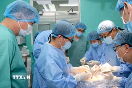 Êkíp thực hiện ca ghép tạng tại Bệnh viện Trung ương Huế. (Ảnh: TTXVN phát)