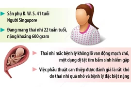 Can thiệp thành công cho thai nhi 22 tuần tuổi "sang điều trị" tại Việt Nam