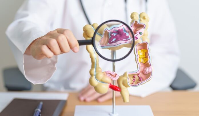 Những tổn thương đường tiêu hóa như loét hoặc xuất huyết có thể được điều trị bằng máy in sinh học cỡ viên thuốc. (Nguồn: Getty Images)