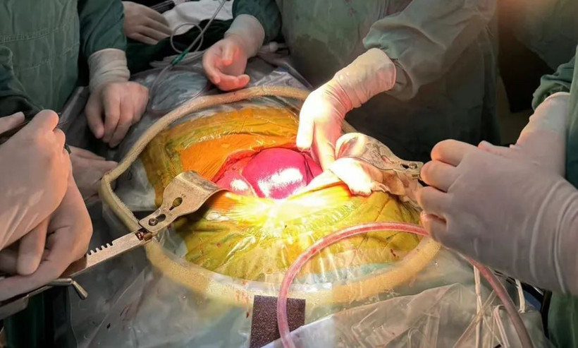 Các bác sỹ thực hiện ca phẫu thuật. (Ảnh: Beicheng Sun)