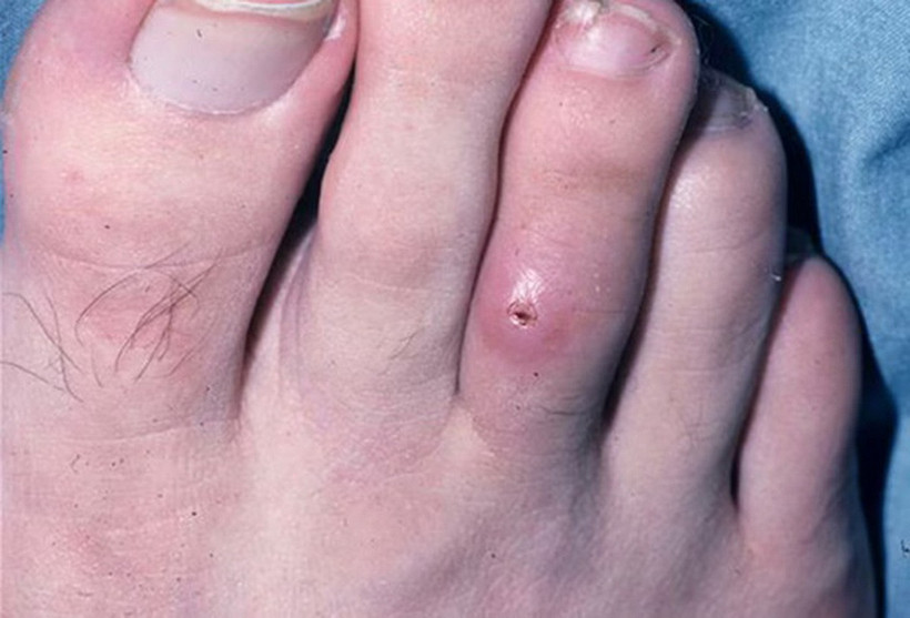 Ảnh minh họa. (Nguồn: medscape)