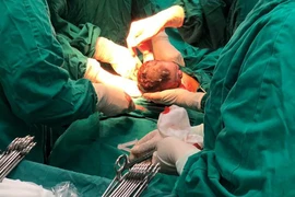 Bé Đàm Thị Phương Mai cất tiếng khóc chào đời lúc 0 giờ 3 phút ngày 1/1/2019 bằng phương pháp sinh mổ. (Nguồn: Bệnh viện Phụ sản Trung ương)