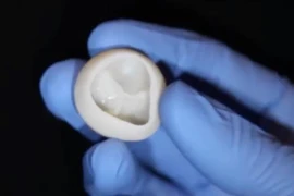 Một van tim chức năng không có collagen được tạo ra bằng máy in 3D. (Ảnh: AFP)