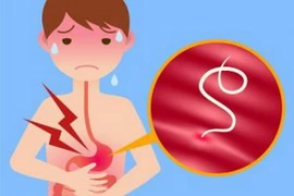 Ảnh minh họa. (Nguồn: newstodaynet.com)