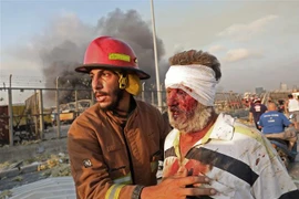 Nạn nhân bị thương trong vụ nổ. (Ảnh: AFP/TTXVN)