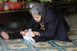 Căn bệnh phong quái ác đã cướp đi sự lành lặn trên cơ thể những bệnh nhân nơi trại phong Quả Cảm (Yên Phong, Bắc Ninh). (Ảnh: Văn Quế/Vietnam+)