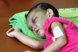 [Photo] Nỗi đau xót lòng vụ bé gái bị bạo hành ở Bình Dương