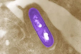 Vi khuẩn Listeria. (Ảnh: Reuters)